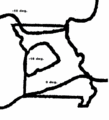 Thumbnail for version as of 11:32, 25 September 2007